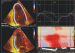 Abb. 8: Strain-Analyse