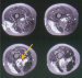 Abb. 2: MR-Angiographie