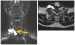 Abb. 5: MR Malformation