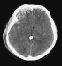 Abb. 3: cCT