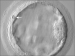 Abb. 4: Blastocyst