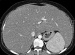 Abb. 1a: MDCT