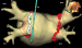 Abb. 1: Pace-and-Ablate-Strategie 