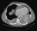 Abb. 3: Thorax