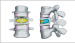 Abb. 3: FEM - BKP