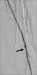 Abb. 2: Ballonangioplastie