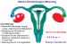 Abb. 2: Uterus-Sondenlängen-Messung