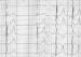 Abb. 7: Epsilonpotentiale