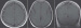 Fig. 1: MRI
