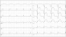 Aktuelles Bild - Abb. 1: EKG