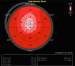 Abb. 2: Bull's Eye-View