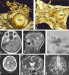 Abb. 7a-h: Riesenaneurysma