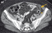 Abb. 1a: MDCT