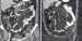 Abb. 1b-c: MDCT