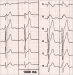 Aktuelles Bild - Abb. 1: ECG leads