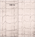 Abb. 2: ECG leads