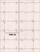 Abb. 3: ECG leads