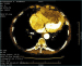 Abb. 7: Thorax-CT