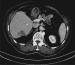 Aktuelles Bild - Abb. 1: Abdomen