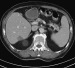Abb. 2: Abdomen