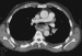 Aktuelles Bild - Abb. 1: CT
