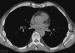 Abb. 2: CT-Abdomen