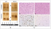 This Image - Fig. 1a-c: Molecular markers in glioma