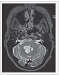 Fig. 1: Axial Image