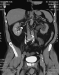 Aktuelles Bild - Abb. 1: Abdomen