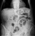 Aktuelles Bild - Abb. 1: Abdomen