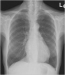 Abb. 2: Thorax-Röntgen