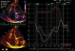 Abb. 8: Strainanalyse