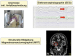 Abb. 4: Epilepsie - Diagnostik