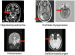Abb. 5: Befundung - Epilepsie
