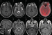 Fig. 1a-h: Brain - MRI