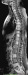This Image - Fig. 1: Spine