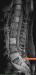 Fig. 2: Spine