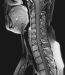 Fig. 3: Spine