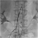Abb. 1: Arteria mesenterica superior