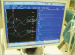 Abb. 4: Hirnmonitoring