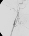 Abb. 5: Angiographie