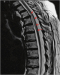 Abb. 3: Arteria-spinalis-anterior-Syndrom