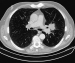 Abb. 2b: Thorax-CT