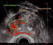 Aktuelles Bild - Abb. 1: HistoScanning