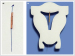 Aktuelles Bild - Abb. 1: Gynefix(R)