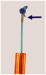 Abb. 2: Gynefix(R)