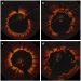 Aktuelles Bild - Abb. 1a-d: Stent-Struts