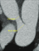 Abb. 9: PDA