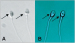 Aktuelles Bild - Abb. 2a-b: Sperm