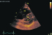 Abb. 3: Septum